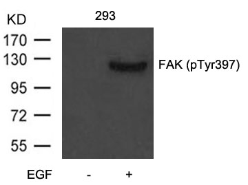 FAK(Phospho-Tyr397) Antibody