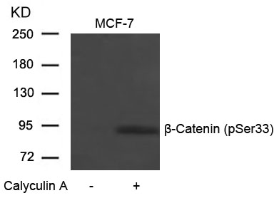 b-Catenin(Phospho-Ser33) Antibody
