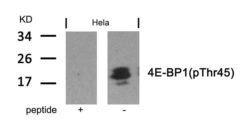 4E-BP1(Phospho-Thr46) Antibody