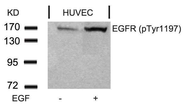 EGFR(Phospho-Tyr1197) Antibody