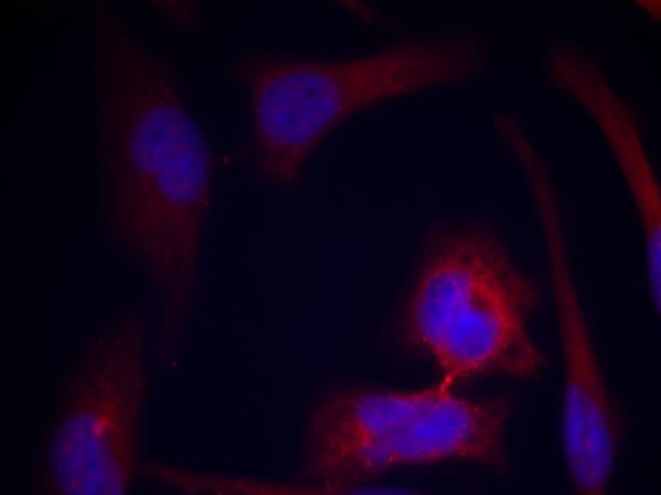 S6 Ribosomal Protein(Phospho-Ser235) Antibody