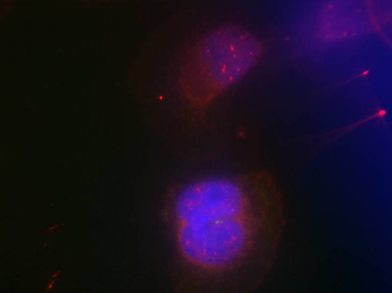 BRCA1(Phospho-Ser988) Antibody