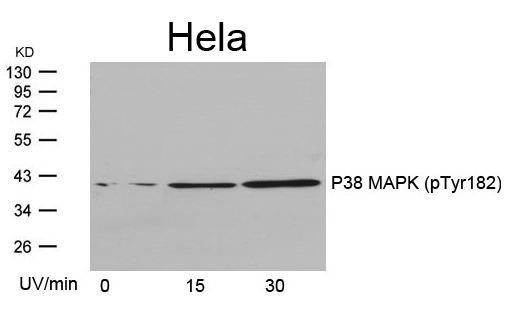 P38 MAPK(Phospho-Tyr182) Antibody