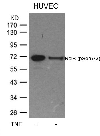 RelB(Phospho-Ser573) Antibody