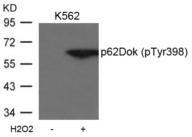 p62Dok(phospho-Tyr398) Antibody