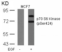 p70 S6 Kinase(Phospho-Ser424) Antibody