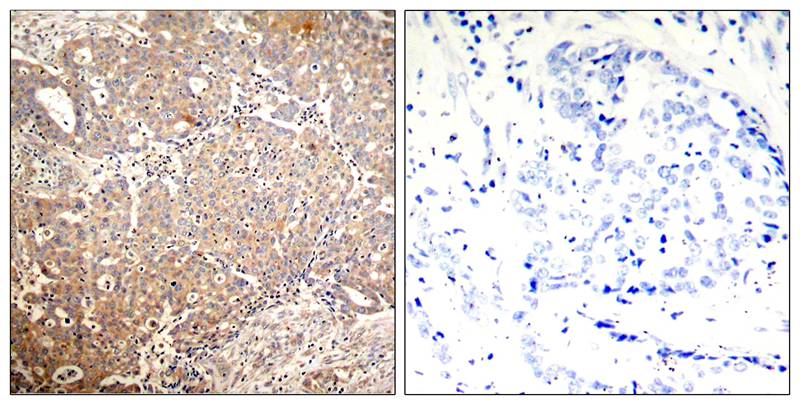 Keratin 18(Phospho-Ser33) Antibody