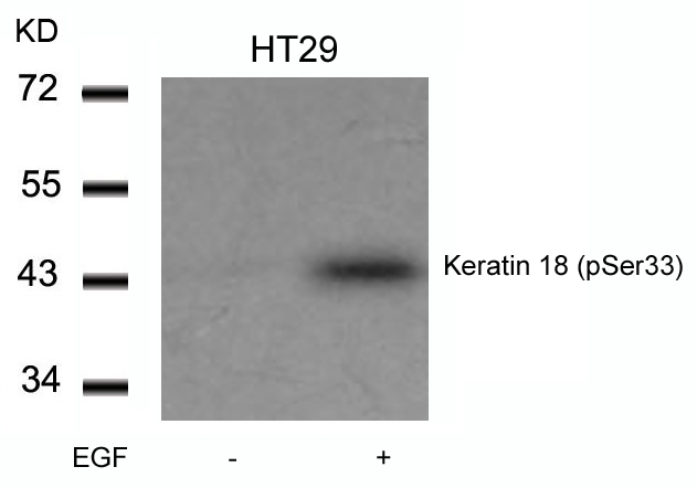 Keratin 18(Phospho-Ser33) Antibody