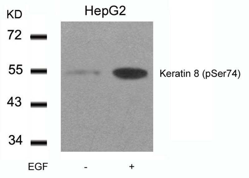 Keratin 8(Phospho-Ser74) Antibody