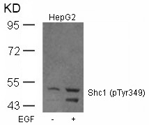 Shc1(Phospho-Tyr349) Antibody