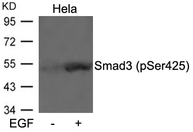Smad3(Phospho-Ser425) Antibody