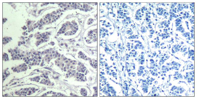 AKT1/AKT2/AKT3(phospho-Tyr315/316/312) Antibody