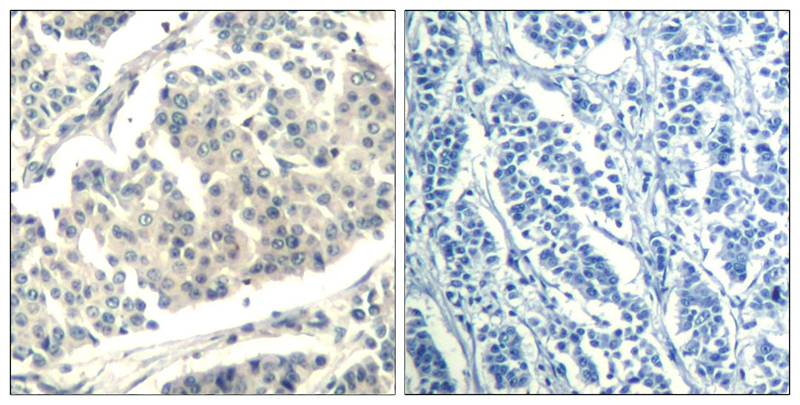 ABL1/2 (phospho-Tyr393/439) Antibody