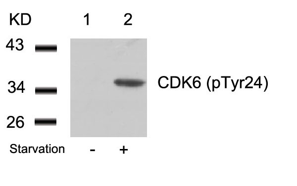 CDK6(phospho-Tyr24) Antibody