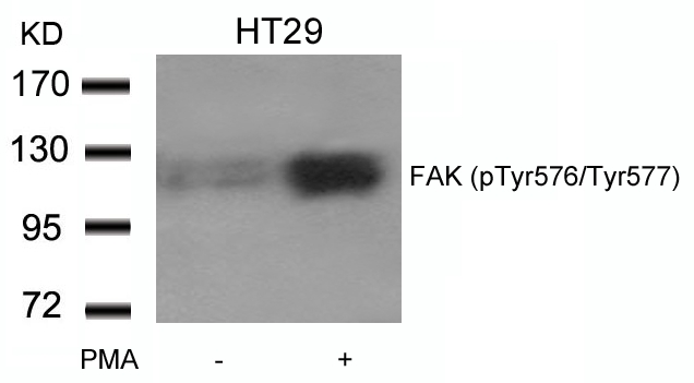 FAK(phospho-Tyr576/Tyr577) Antibody