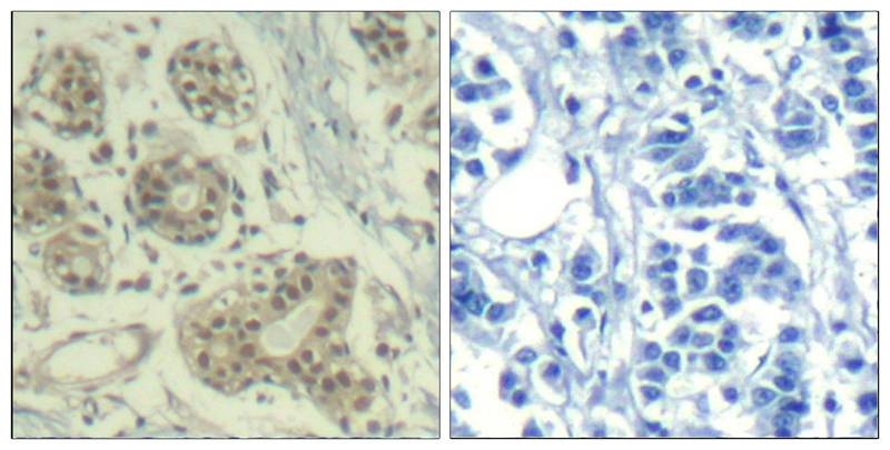 MDM2(phospho-Ser166) Antibody