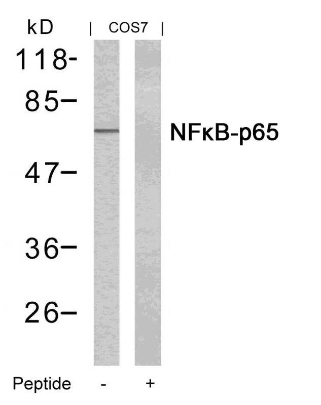 NFkB-p65(Ab-435) Antibody
