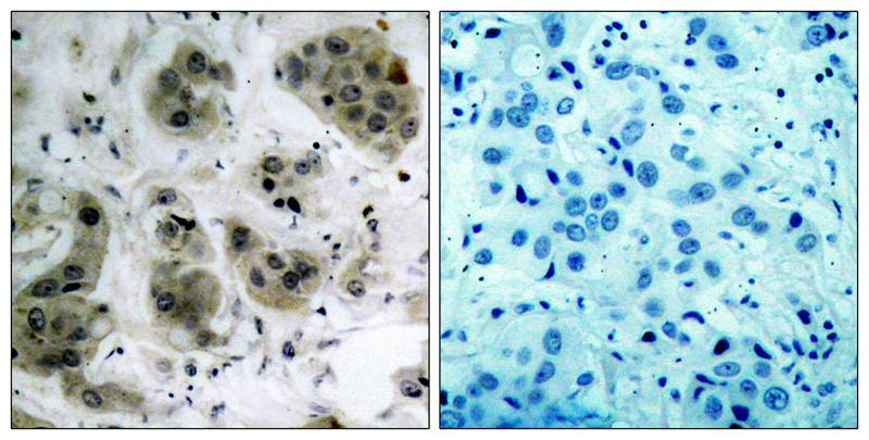 Akt(Ab-473) Antibody