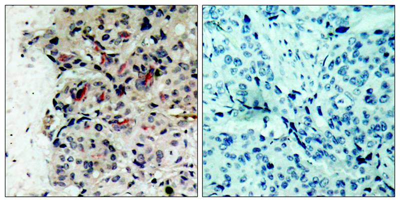 JAK1(Ab-1022) Antibody