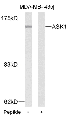 ASK1(Ab-83) Antibody