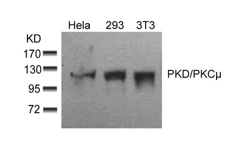PKD/PKCm(Ab-910) Antibody
