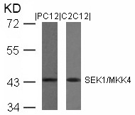 SEK1/MKK4(Ab-80) Antibody