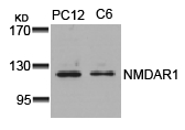 NMDAR1(Ab-896) Antibody