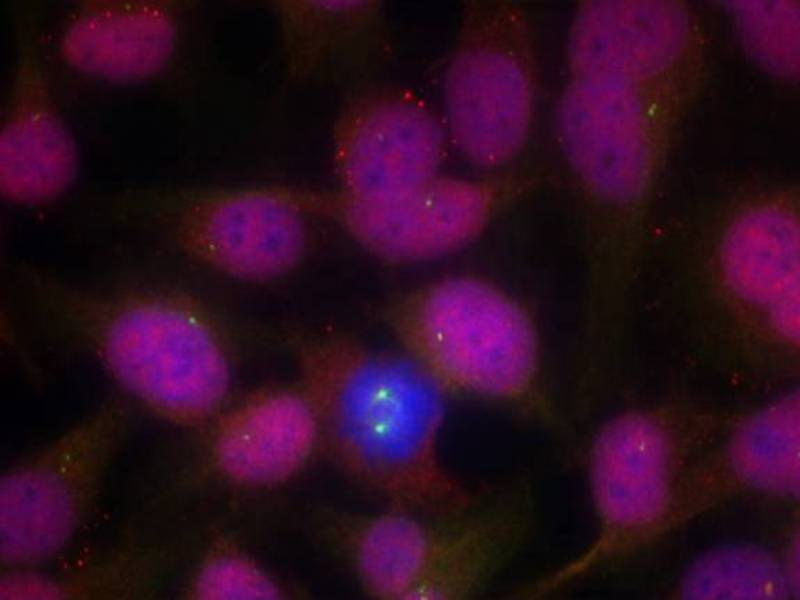 ATM(Ab-1981) Antibody