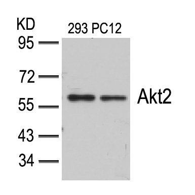 Akt2(Ab-474) Antibody