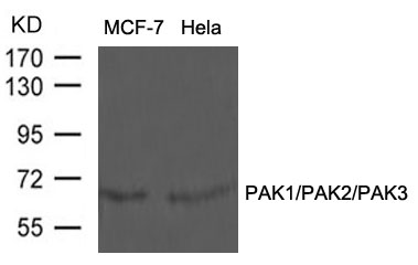 PAK1/PAK2/PAK3(Ab-423/402/421) Antibody
