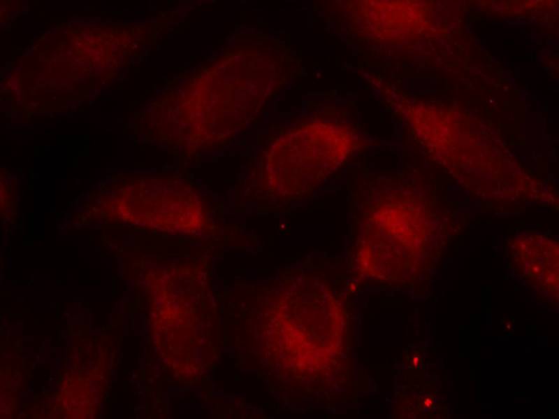 p70 S6 Kinase(Ab-389) Antibody