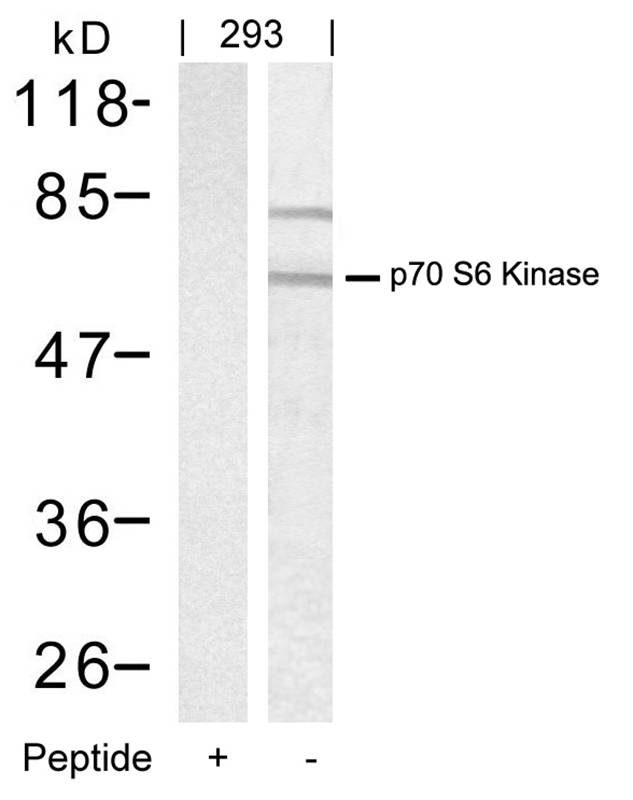 p70 S6 Kinase(Ab-389) Antibody