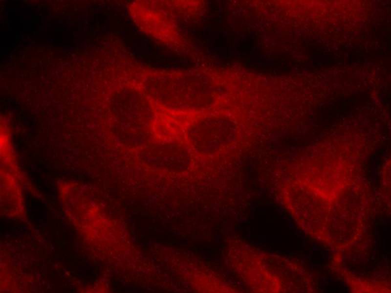 Bcr(Ab-177) Antibody