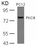 PKCth(Ab-676) Antibody