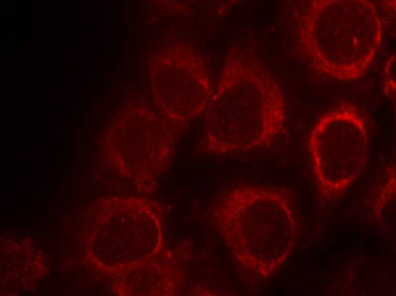 Smad1(Ab-465) Antibody