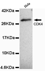 CDK4(N-term) Monoclonal Antibody