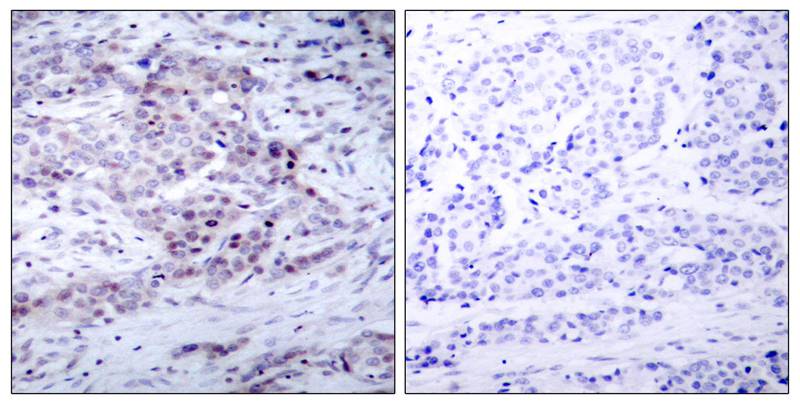 NFκB-p100/p52(Phospho-Ser870) Antibody