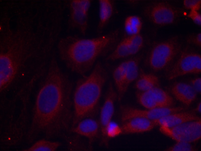 NFκB-p105/p50(Phospho-Ser893) Antibody