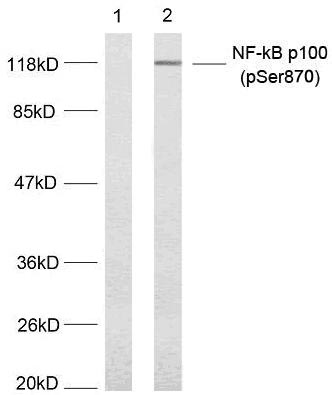 NFκB-p100/p52(Phospho-Ser870) Antibody