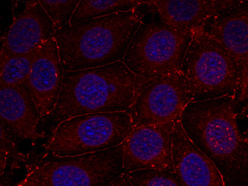 IGF-1R(Phospho-Tyr1161) Antibody