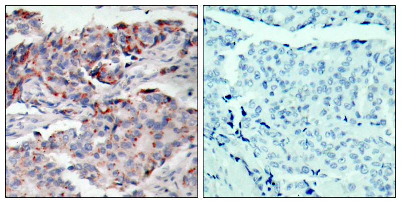 JAK2(Phospho-Tyr221) Antibody