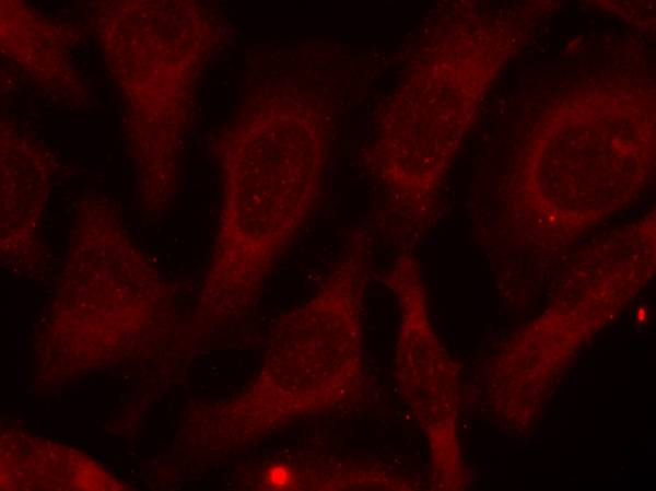 CARM1(Phospho-Ser228) antibody