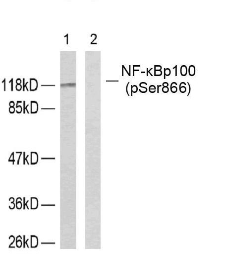 NFκB-p100/p52(Phospho-Ser866) Antibody