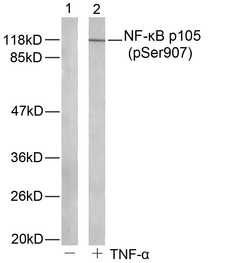 NFκB-p105/p50(Phospho-Ser907) Antibody