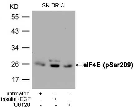 eIF4E(Phospho-Ser209) Antibody