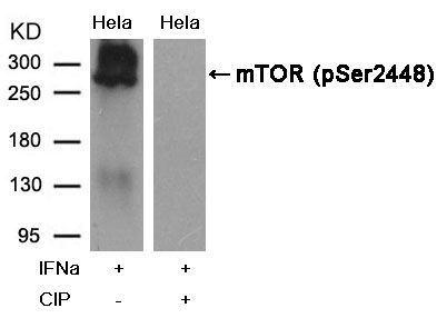 mTOR(Phospho-Ser2448) Antibody