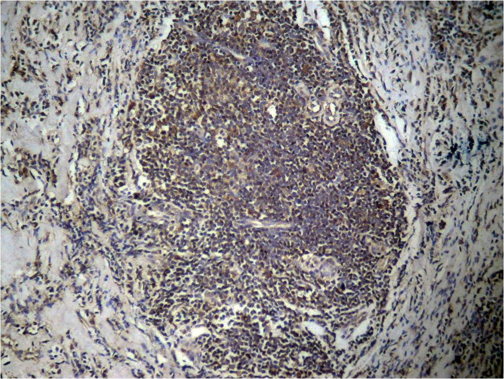 Histone H3 (Di-Methyl-Lys27) Antibody 