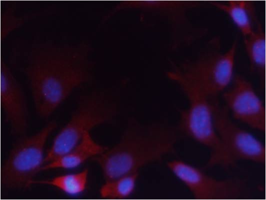 PTEN(Phospho-Ser380/Thr382/Thr383) Antibody