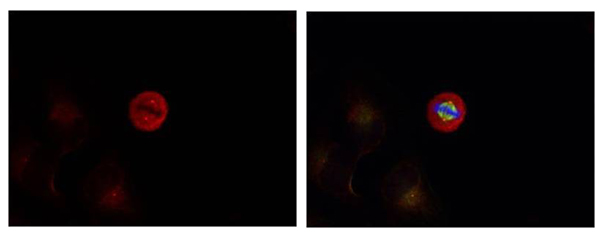 p44/42 MAP Kinase(Phospho-Tyr204) Antibody