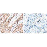 GNRHR Antibody